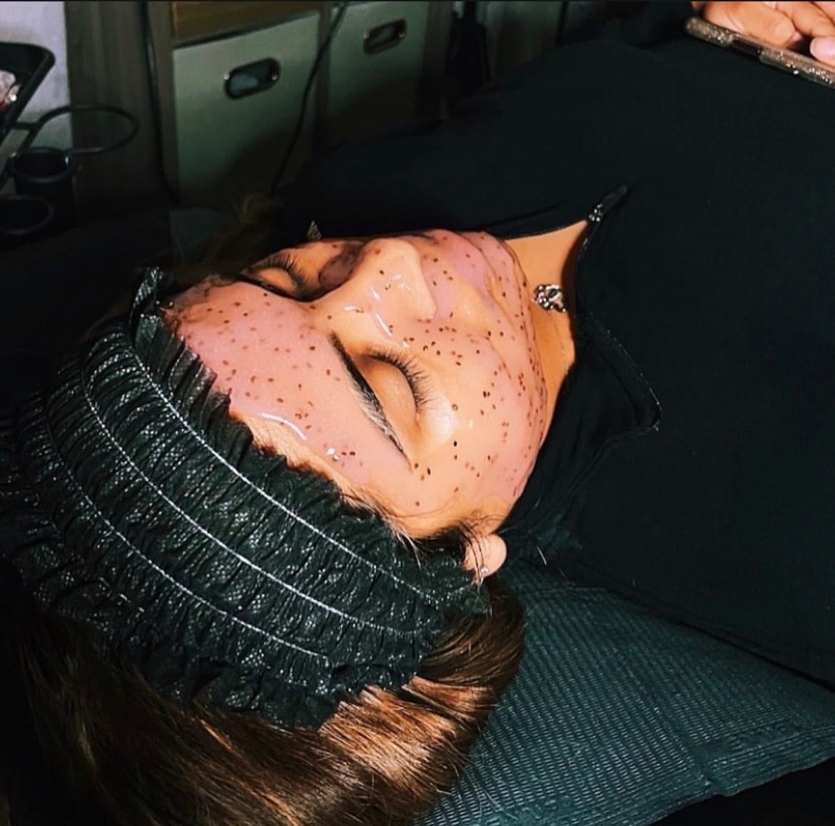 Botox